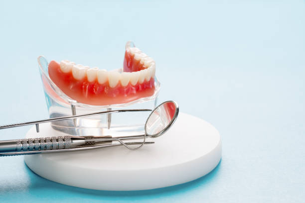 Dental Bonding in Charlotte, MI