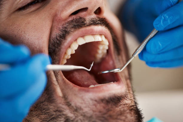 Best Full Mouth Reconstruction  in Charlotte, MI